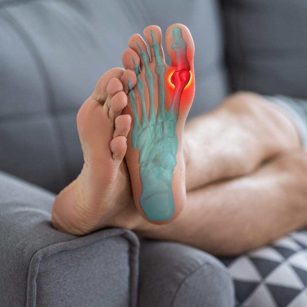 Plantar fasciitis relief with outcall massage in Kuala Lumpur